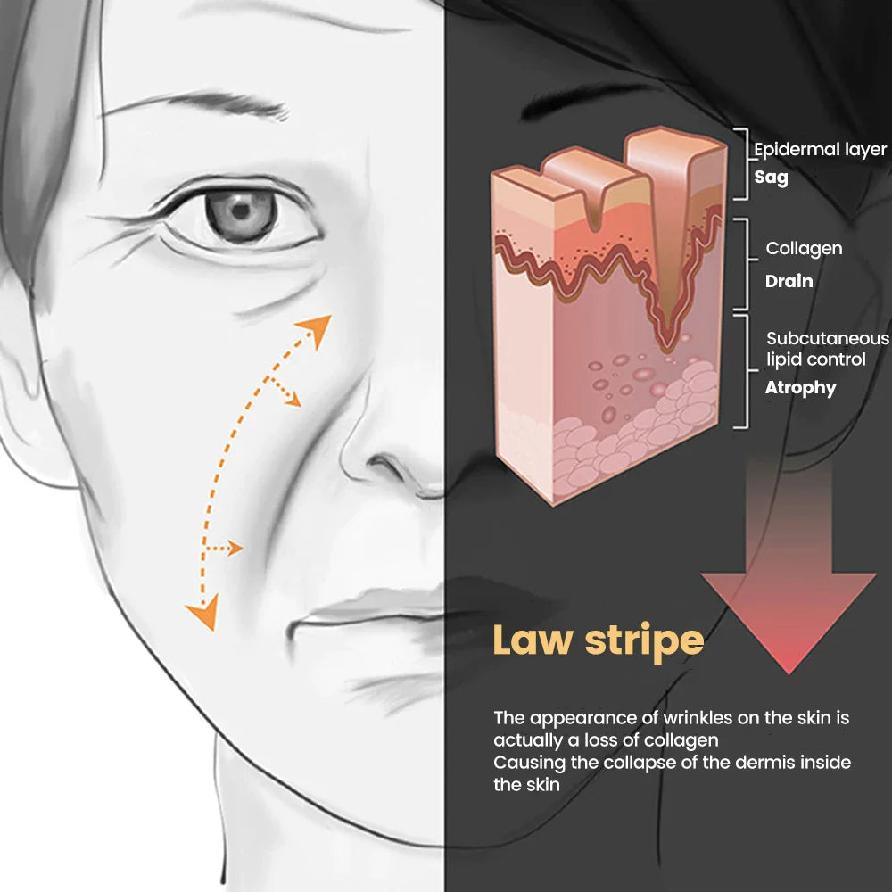 Lifting Mask for Nasolabial Lines